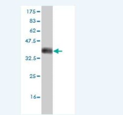 DCAMKL2 Antibody (2A5), Novus Biologicals 0.1 mg; Unconjugated:Antibodies,