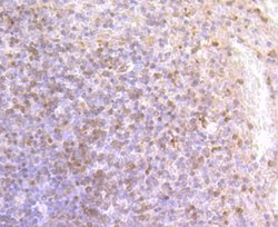 DCLK1 Rabbit anti-Human, Clone: JA11-03, Novus Biologicals 100&mu;L:Antibodies,