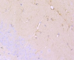 DCLK1 Rabbit anti-Human, Clone: JA11-03, Novus Biologicals 100&mu;L:Antibodies,