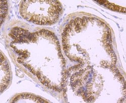 DCLK1 Rabbit anti-Human, Clone: JA11-03, Novus Biologicals 100&mu;L:Antibodies,