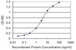 DCLK1 Antibody (7D10), Novus Biologicals 0.1 mg, Unconjugated:Anticorps,