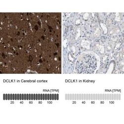 DCLK1 Antibody, Novus Biologicals:Antibodies:Primary Antibodies