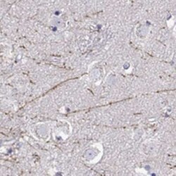 DCLK3 Antibody, Novus Biologicals 100 &mu;g; Unconjugated:Antibodies, Polyclonal