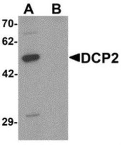 DCP2 Antibody - BSA Free, Novus Biologicals 0.1 mg | Buy Online | Novus Biologicals | Fisher Scientific