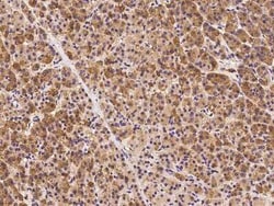 DCTN3 Antibody, Novus Biologicals 100 &mu;g, Unconjugated:Antibodies, Polyclonal