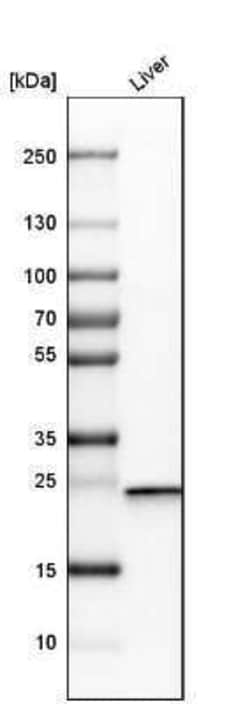 DCXR Antibody, Novus Biologicals 0.1 mL; Unconjugated:Antibodies, Polyclonal