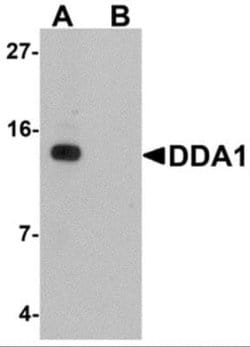 DDA1 Antibody - BSA Free, Novus Biologicals 0.1 mg; Unconjugated:Antibodies,