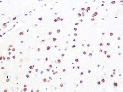 DDB1 Rabbit anti-Human, Mouse, Rat, Clone: 9L8X5, Novus Biologicals:Antibodies:Primary