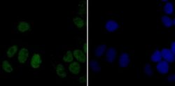 DDB1 Rabbit anti-Human, Mouse, Rat, Clone: JU32-35, Novus Biologicals 100