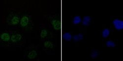 DDB1 Rabbit anti-Human, Mouse, Rat, Clone: JU32-35, Novus Biologicals 100