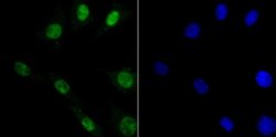 DDB1 Rabbit anti-Human, Mouse, Rat, Clone: JU32-35, Novus Biologicals 100