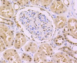DDB1 Rabbit anti-Human, Mouse, Rat, Clone: JU32-35, Novus Biologicals 100