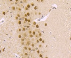 DDB1 Rabbit anti-Human, Mouse, Rat, Clone: JU32-35, Novus Biologicals 100