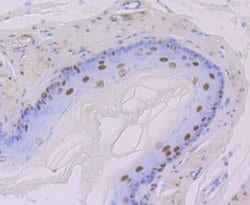 DDB1 Rabbit anti-Human, Mouse, Rat, Clone: JU32-35, Novus Biologicals 100