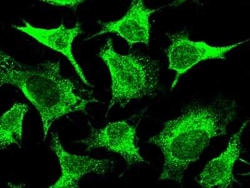 DDB1 Antibody, Novus Biologicals:Antibodies:Primary Antibodies