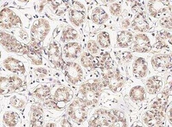 DDB1 Antibody, Novus Biologicals:Antibodies:Primary Antibodies