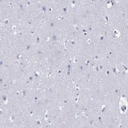 DDI1 Rabbit anti-Human, Polyclonal, Novus Biologicals 25 &mu;g; Unconjugated:Antibodies,