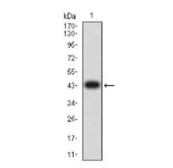 DDR1 Antibody (4F2C12) - BSA Free, Novus Biologicals:Antibodies:Primary