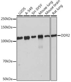 DDR2 Rabbit anti-Human, Mouse, Rat, Clone: 1M8U7, Novus Biologicals:Antibodies:Primary