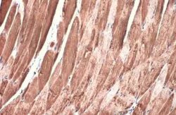 DDR2 Antibody (HL1107), Novus Biologicals 100 &mu;g | Buy Online | Novus Biologicals | Fisher Scientific