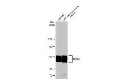 DDR2 Antibody (HL1107), Novus Biologicals 100 &mu;g | Buy Online | Novus Biologicals | Fisher Scientific