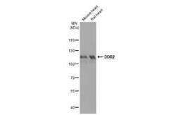DDR2 Antibody (HL1107), Novus Biologicals 100 &mu;g | Buy Online | Novus Biologicals | Fisher Scientific