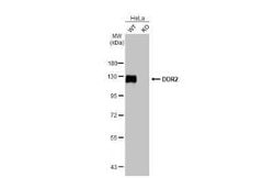 DDR2 Antibody (HL1107), Novus Biologicals 100 &mu;g | Buy Online | Novus Biologicals | Fisher Scientific