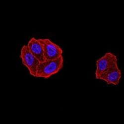 DDX1 Antibody (3E5B2) - BSA Free, Novus Biologicals 0.1 ml; Unconjugated:Antibodies,
