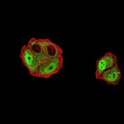 DDX1 Antibody (3E5B2) - BSA Free, Novus Biologicals 0.1 ml; Unconjugated:Antibodies,