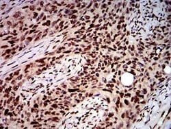 DDX1 Antibody (3E5B2) - BSA Free, Novus Biologicals 0.1 ml; Unconjugated:Antibodies,