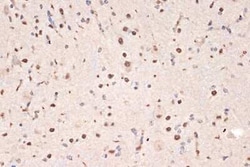 DDX17 Rabbit anti-Human, Mouse, Rat, Clone: 2U1P0, Novus Biologicals 20