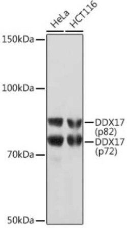 DDX17 Rabbit anti-Human, Mouse, Rat, Clone: 2U1P0, Novus Biologicals 20