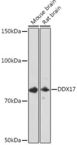 DDX17 Rabbit anti-Human, Mouse, Rat, Clone: 2U1P0, Novus Biologicals 20