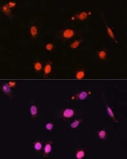 DDX17 Antibody - Azide and BSA Free, Novus Biologicals 0.02 mL, Unconjugated:Antibodies,