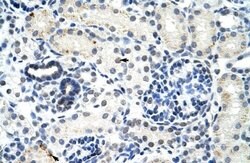 DDX17 Antibody, Novus Biologicals 100 &mu;L | Buy Online | Novus Biologicals | Fisher Scientific