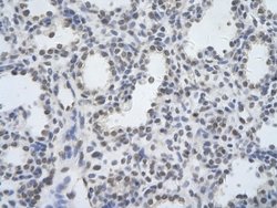 DDX17 Antibody, Novus Biologicals 100 &mu;L | Buy Online | Novus Biologicals | Fisher Scientific
