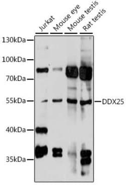DDX25 Antibody - Azide and BSA Free, Novus Biologicals 0.1 mL, Unconjugated:Antibodies,