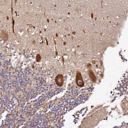 DDX27 Antibody, Novus Biologicals 0.1 mL, Unconjugated:Antibodies, Polyclonal