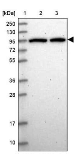 DDX27 Antibody, Novus Biologicals 0.1 mL, Unconjugated:Antibodies, Polyclonal