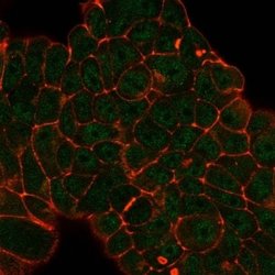 DDX41 Mouse anti-Human, Clone: PCRP-DDX41-1B4, Novus Biologicals:Antibodies:Primary