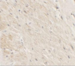 DDX41 Antibody - BSA Free, Novus Biologicals 0.1 mg; Unconjugated:Antibodies,