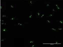 DDX47 Antibody, Novus Biologicals 0.05 mg | Buy Online | Novus Biologicals | Fisher Scientific