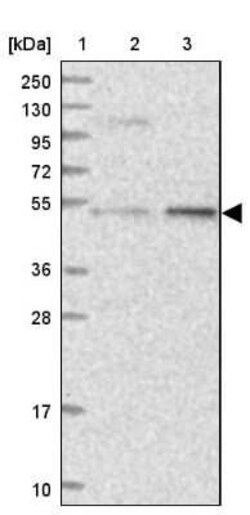 DDX49 Antibody, Novus Biologicals 0.1 mL, Unconjugated:Antibodies, Polyclonal