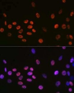 DDX5 Rabbit anti-Human, Mouse, Rat, Clone: 1K6X10, Novus Biologicals:Antibodies:Primary