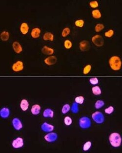 DDX5 Rabbit anti-Human, Mouse, Rat, Clone: 1K6X10, Novus Biologicals:Antibodies:Primary