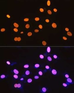 DDX5 Rabbit anti-Human, Mouse, Rat, Clone: 1K6X10, Novus Biologicals:Antibodies:Primary