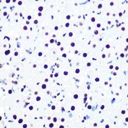 DDX5 Rabbit anti-Human, Mouse, Rat, Clone: 1K6X10, Novus Biologicals:Antibodies:Primary