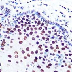 DDX5 Rabbit anti-Human, Mouse, Rat, Clone: 1K6X10, Novus Biologicals:Antibodies:Primary