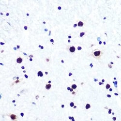 DDX5 Rabbit anti-Human, Mouse, Rat, Clone: 1K6X10, Novus Biologicals:Antibodies:Primary