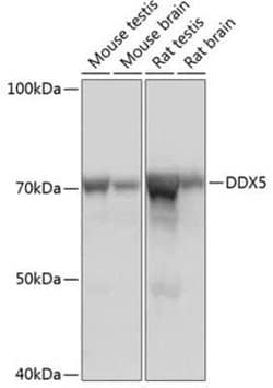 DDX5 Rabbit anti-Human, Mouse, Rat, Clone: 1K6X10, Novus Biologicals:Antibodies:Primary